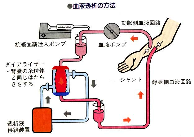 慢性腎臓病（CKD）と人工透析 痛風・人工透析なら東京都墨田区の両国東口クリニック